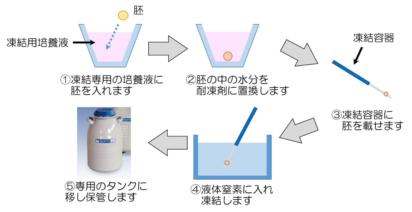 胚凍結の方法