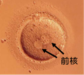 正常に受精した卵子