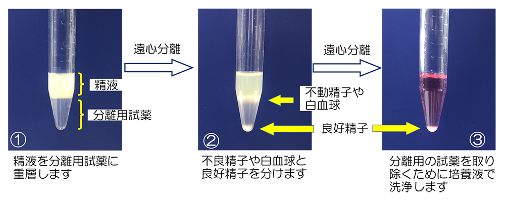 密度勾配法の手順