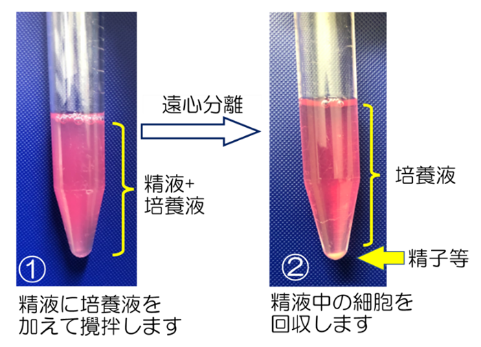 洗浄濃縮法の手順