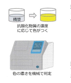 精液の抗酸化力検査(TCA検査)の検査方法