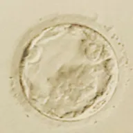 2023年の日本のARTの出生数 約85,000人