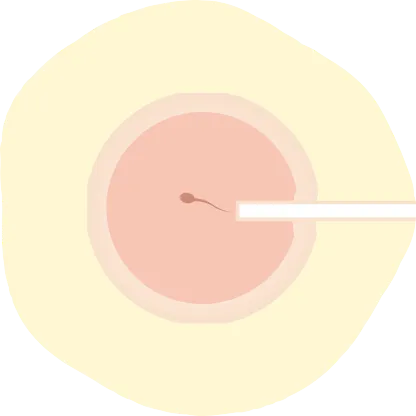 高度生殖補助医療