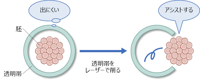 孵化促進法の方法