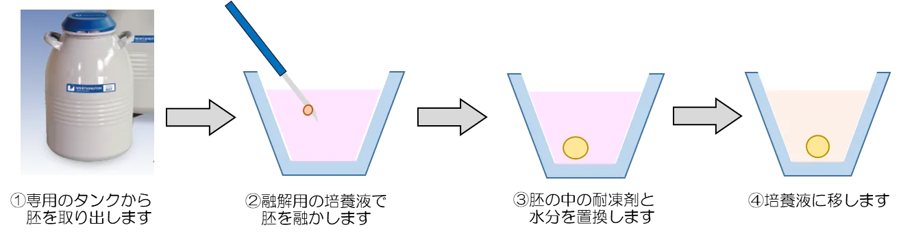 胚凍結の方法