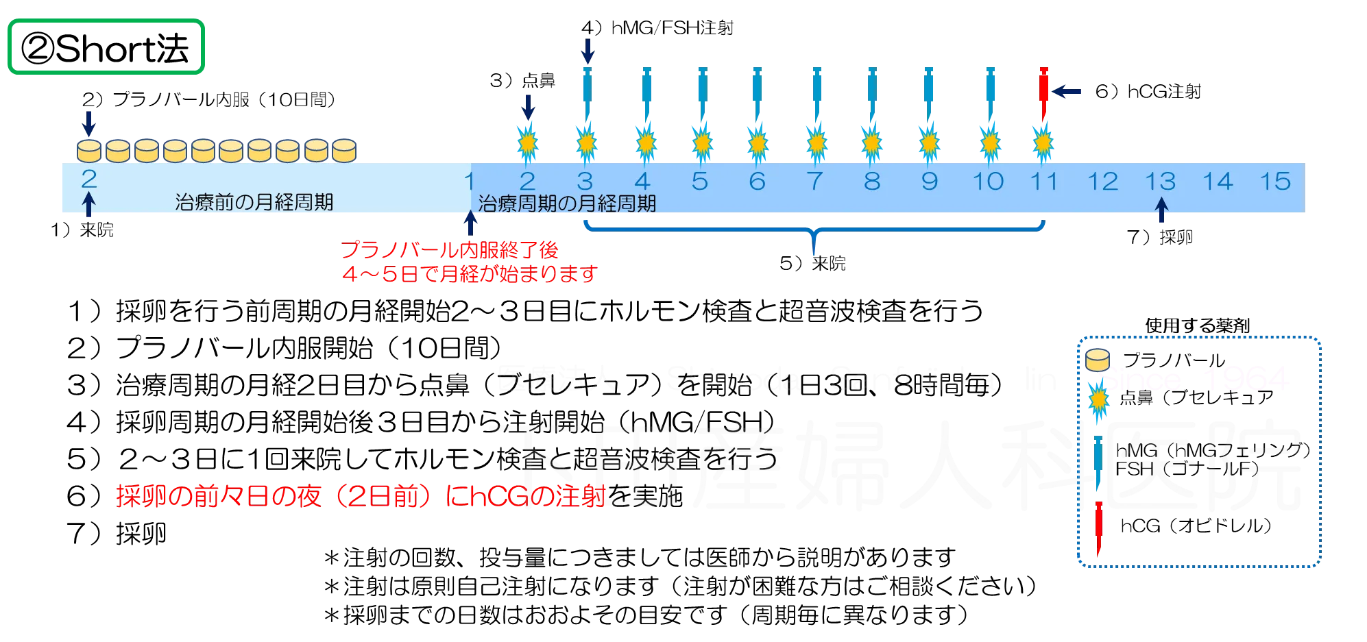 Short法（ショート法）