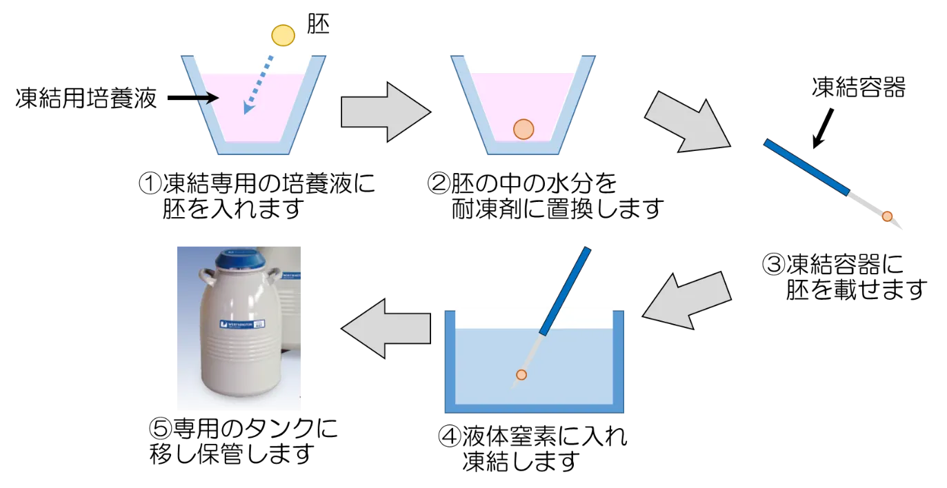 胚凍結の方法