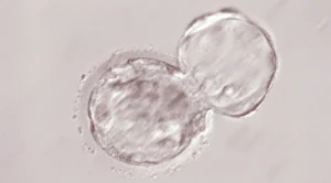 胚移植と補助技術