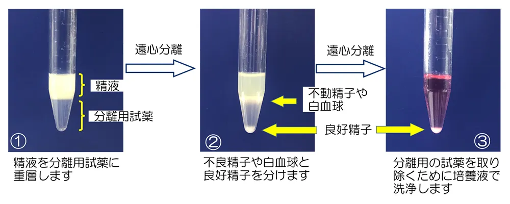 密度勾配法について