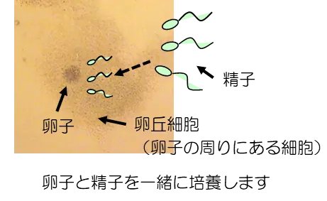 標準体外受精の方法